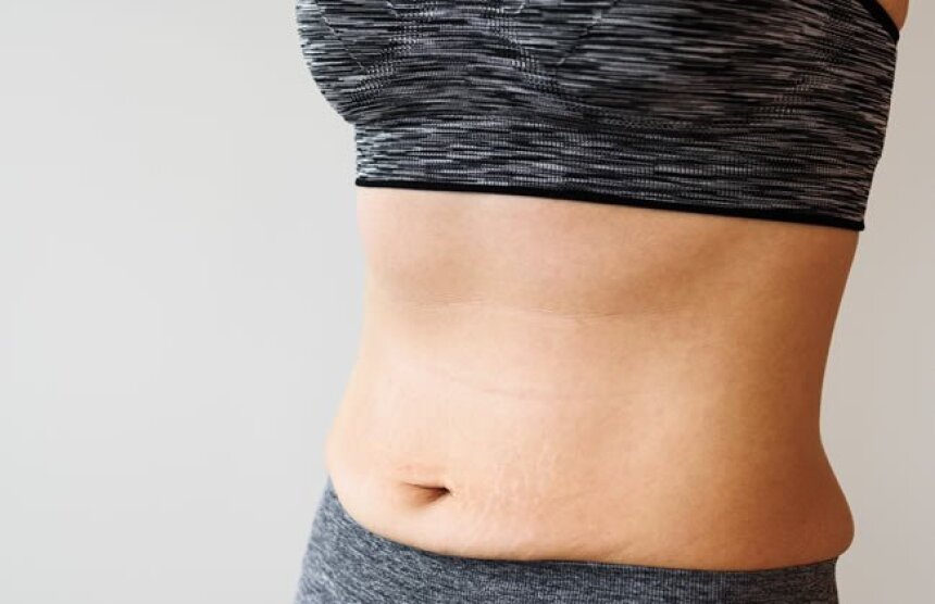 Skinny fat – štíhlá obezita
